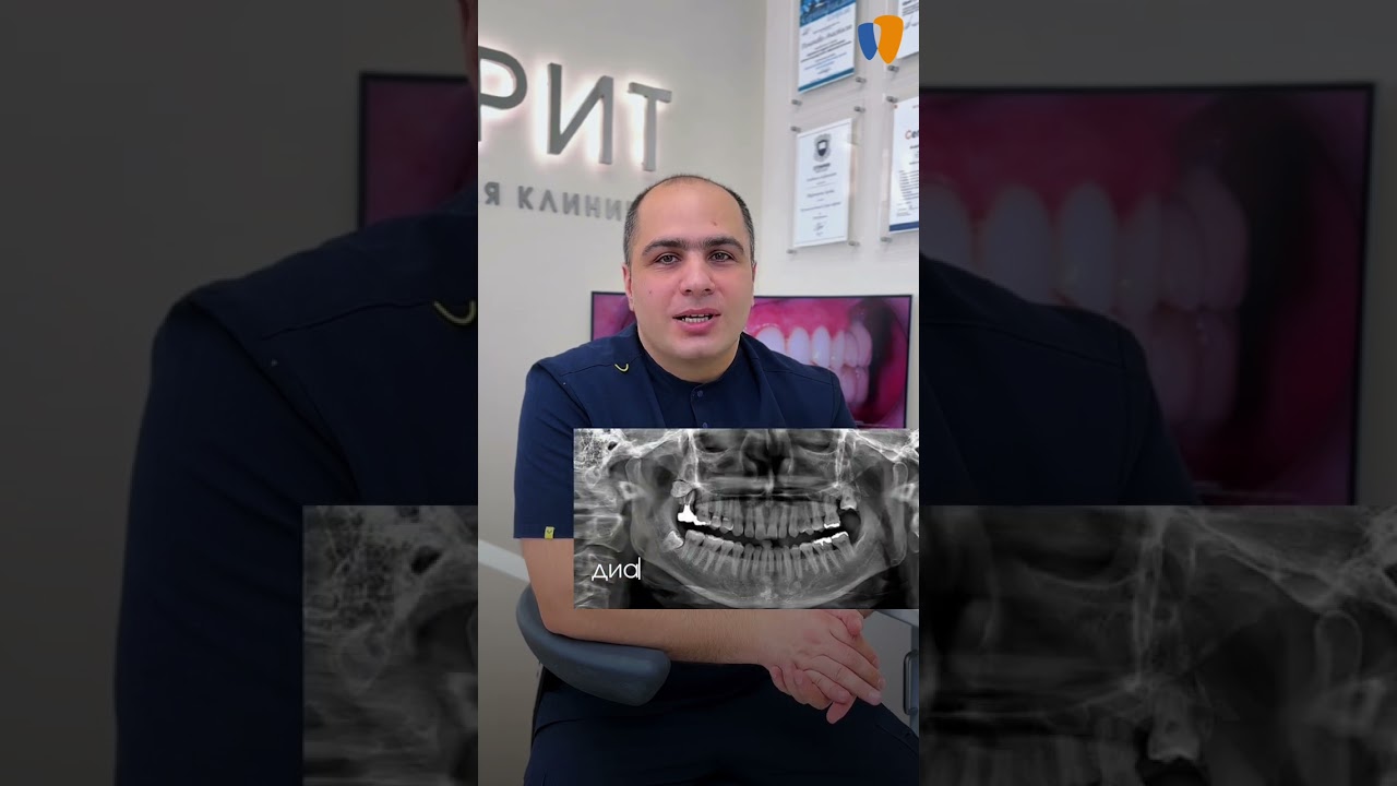 Консультация — важнейший этап в стоматологии!