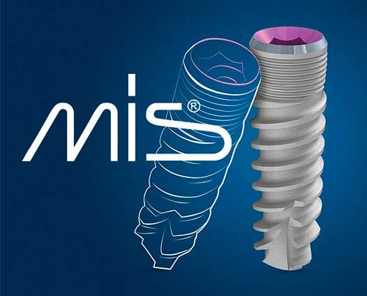 Имплантаты MIS