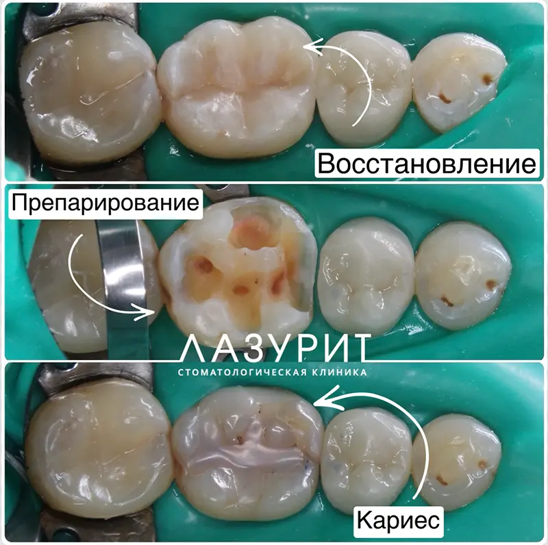 Чем раньше пришел на прием, тем быстрее и дешевле лечение!