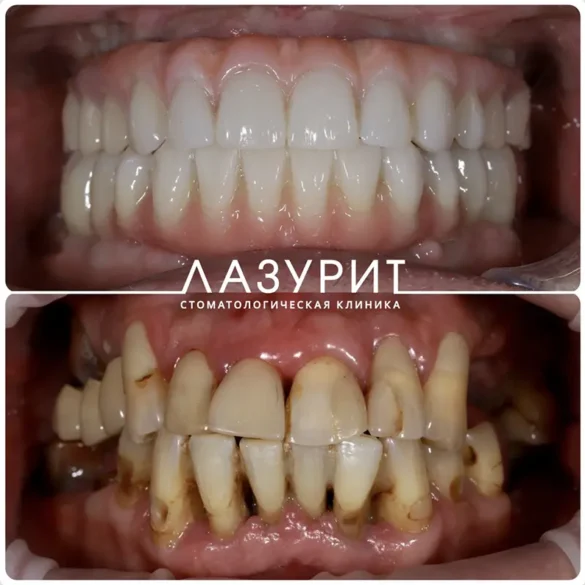 От паники и потери зубов – до новой красивой улыбки!